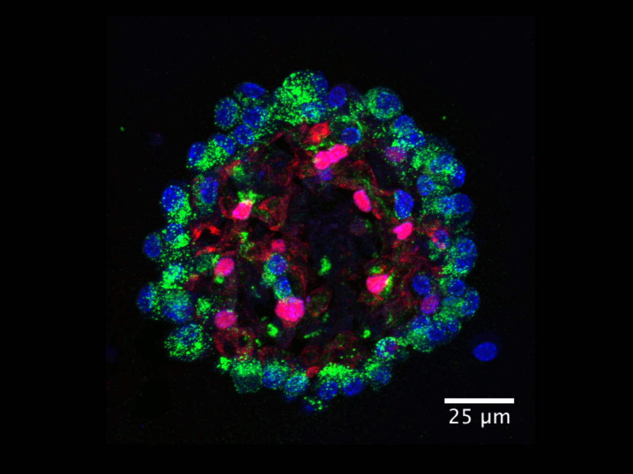Епітеліальні клітини, які знаходяться у людських легенях. The lab of Ed Morrisey, PhD, Perelman School of Medicine, University of Pennsylvania