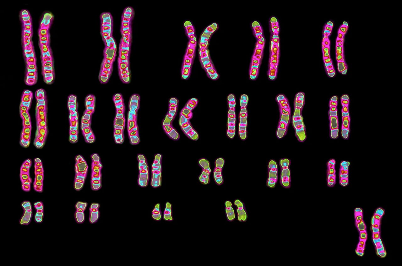Нормальний набір із 46 хромосом у людини (такими вони візуалізуються під час клітинного поділу).&amp;nbsp;James Cavallini / BSIP