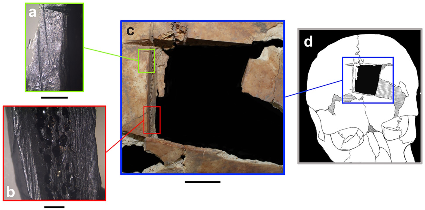 а-с. Збільшене зображення слідів трепанації черепа. d. Реконструкція локації трепанації на голові.&amp;nbsp;Rachel Kalisher et al. /&amp;nbsp;PLOS ONE, 2023