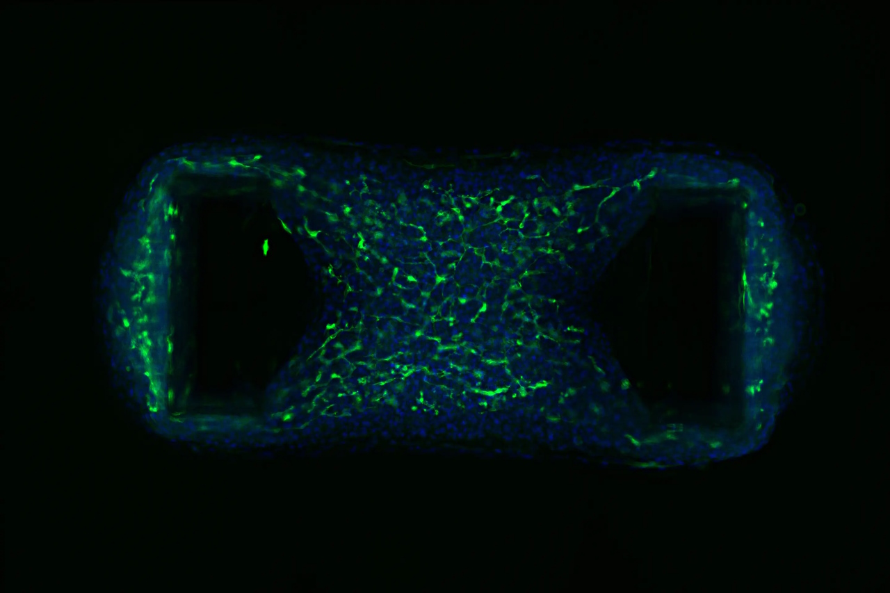 Органоїд людського серця із виділеними клітинами судин.&amp;nbsp;QIMR Berghofer
