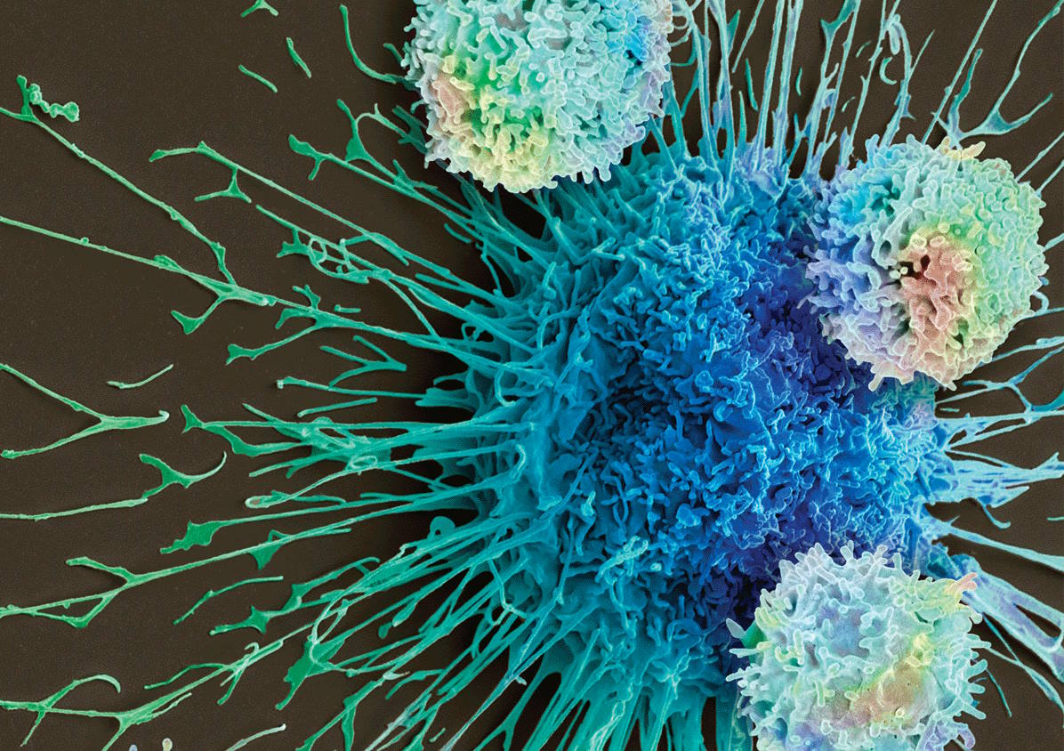 CAR-T-клітини атакують ракову клітину.&amp;nbsp;Steve Gschmeissner / Science Photo Library