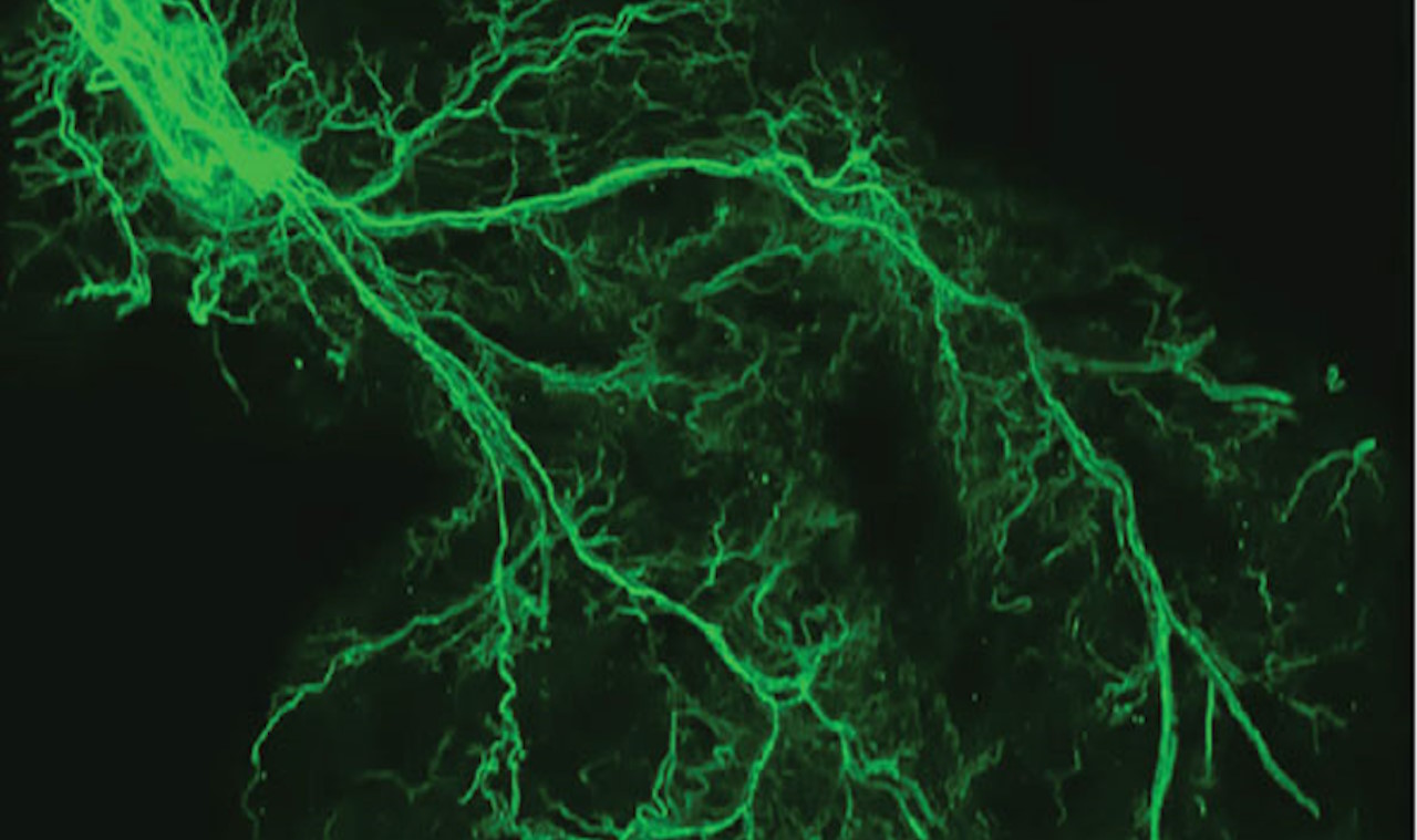 Нерви у жировій тканині, через які відбувається зв'язок з мозком.&amp;nbsp;Kyohei Tokizane