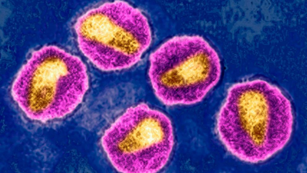 Зображення ВІЛ, отримане з допомогою трансмісійного електронного мікроскопа. BSIP / Universal Images Group / Getty Images
