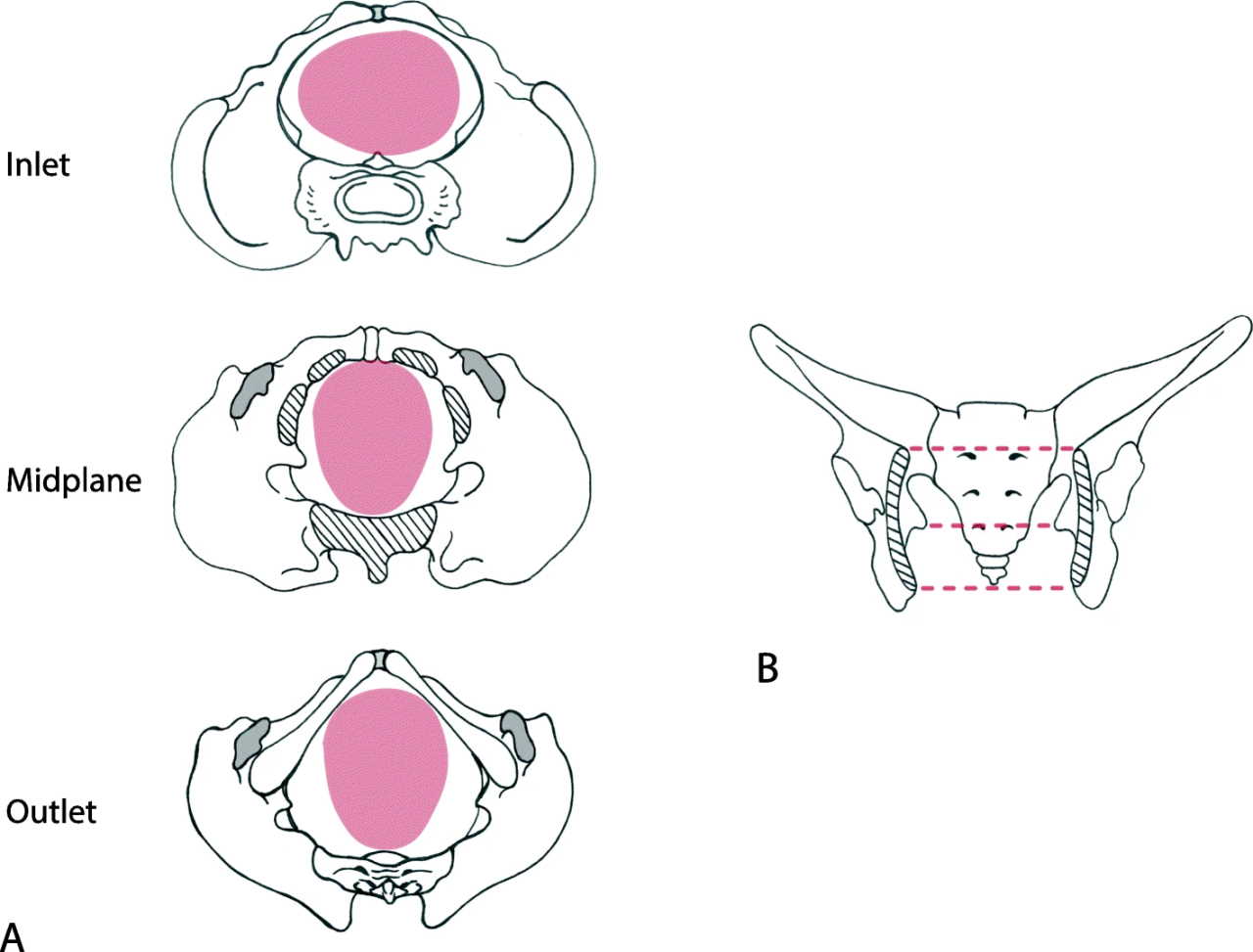 Площини входу, середини та виходу родового каналу людини із демонстрацією повороту голови, що здійснює плід під час проходження їх.&amp;nbsp;Stansfield et al. / BMC Biology, 2021