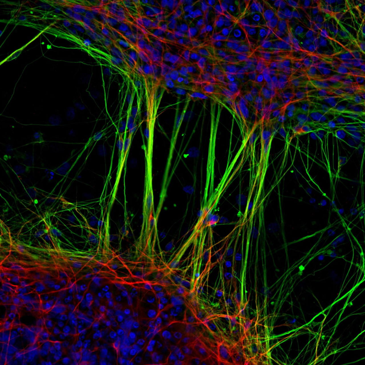 Людські нейрони, отримані зі стовбурових клітин. Dr. Jianqun Gao, Prof. Glenda Halliday