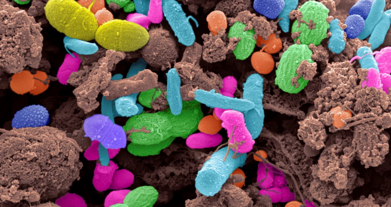 Бактерії з людських фекалій, виділені на зображенні сканувального електронного мікроскопа.&amp;nbsp;Steve Gschmeissner / Science Photo Library
