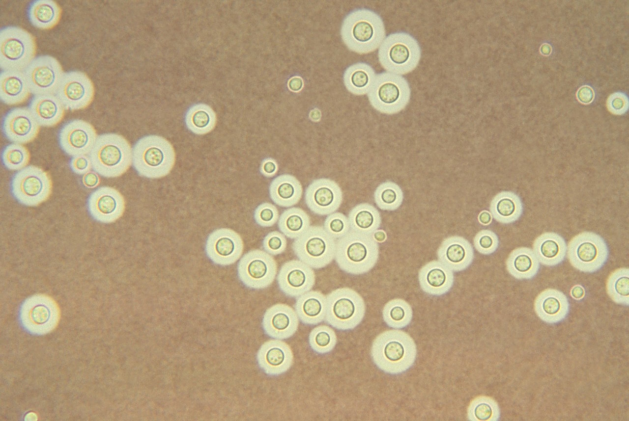 Гриби&amp;nbsp;Cryptococcus&amp;nbsp; під мікроскопом.&amp;nbsp;CDC/ Dr. Leanor Haley /&amp;nbsp;Wikimedia Commons