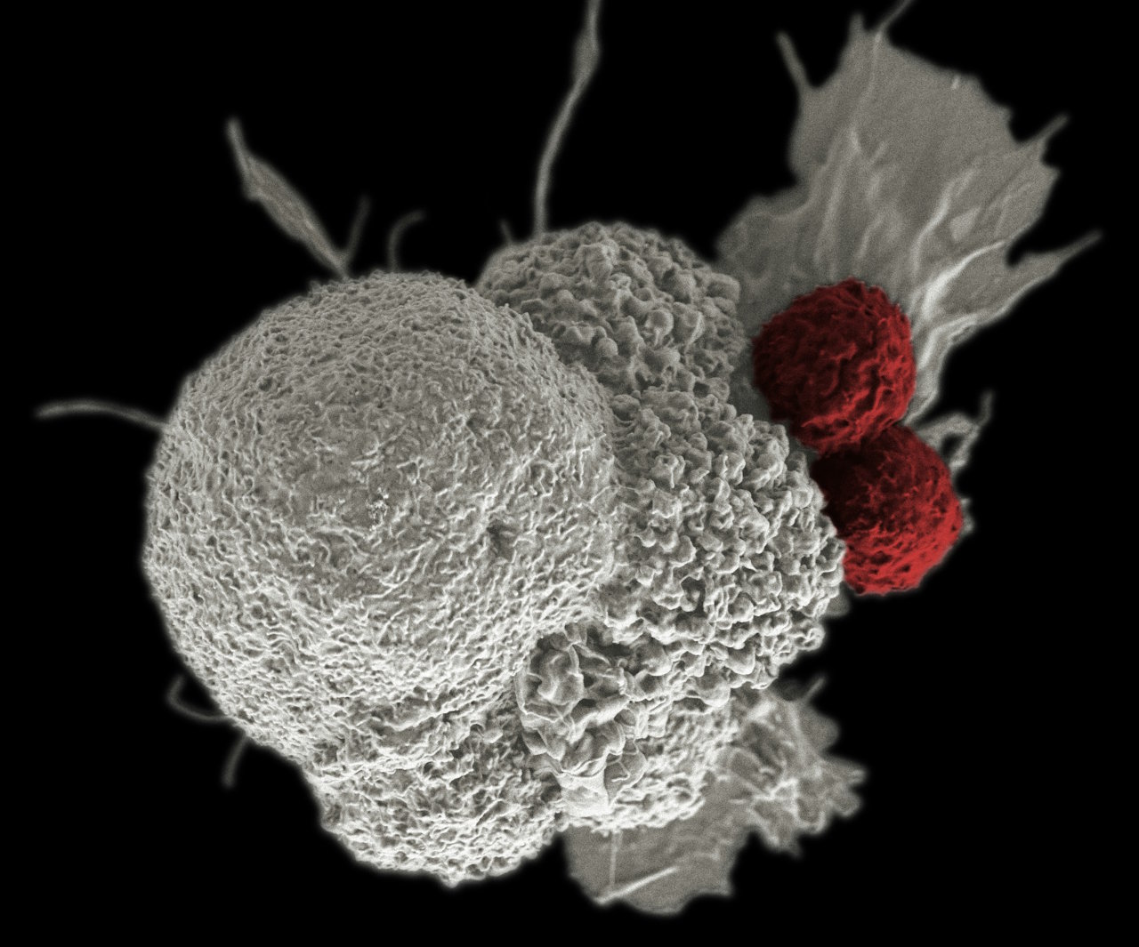 Дві Т-клітини (зафарбовані червоним) атакують пухлину (білим).&amp;nbsp;National Cancer Institute / Unsplash