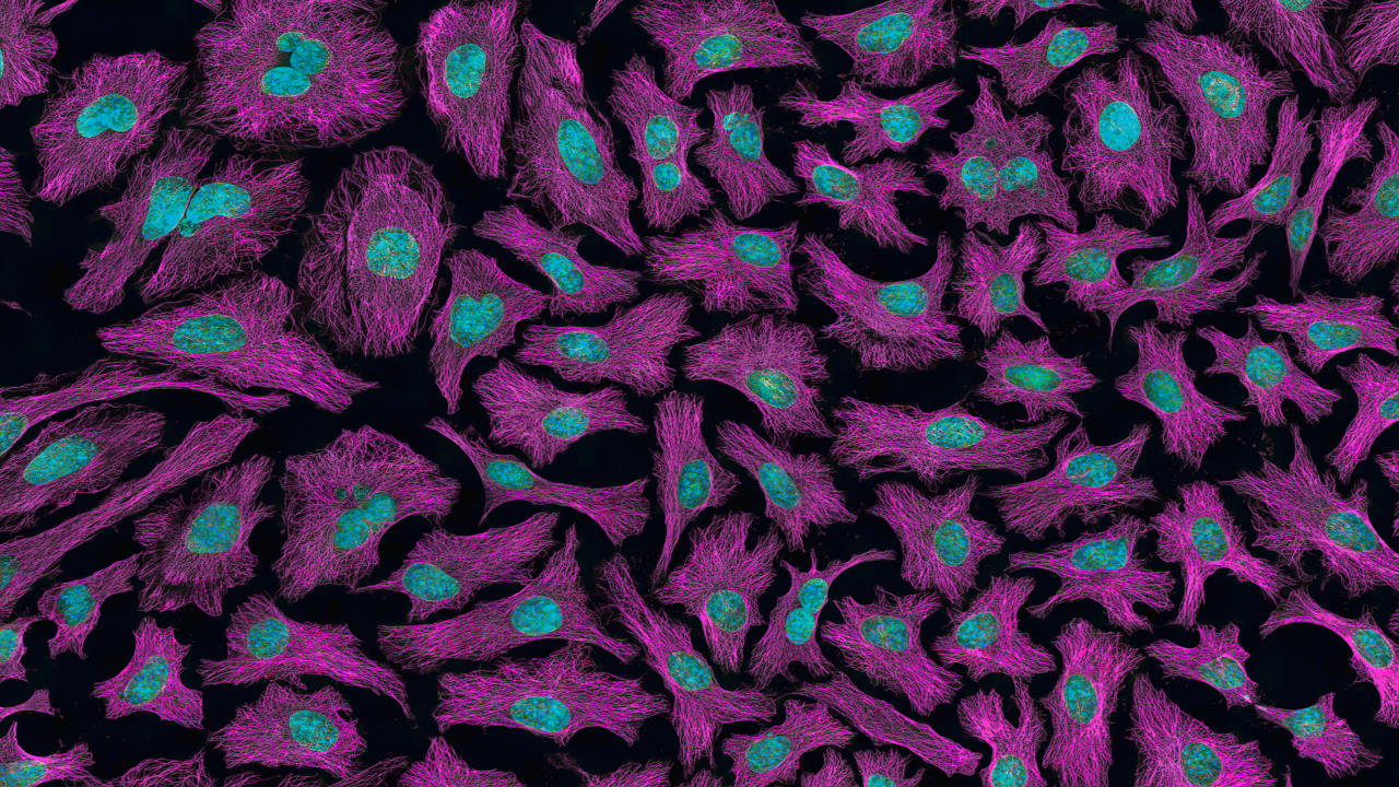 Клітини раку шийки матки.&amp;nbsp;National Cancer Institute / Unsplash
