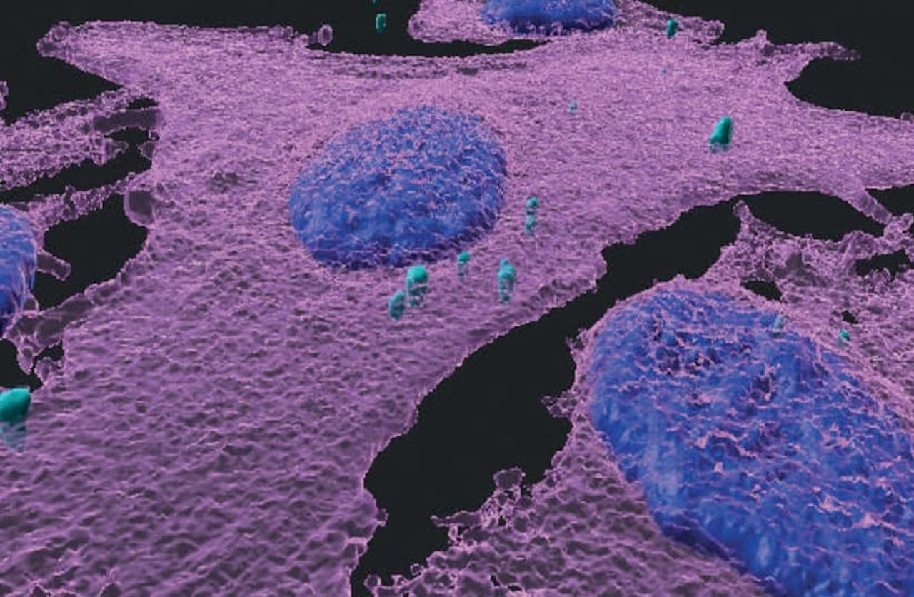 Тривимірне, фарбоване зображення клітин меланоми.&amp;nbsp;WEIZMANN INSTITUTE OF SCIENCE