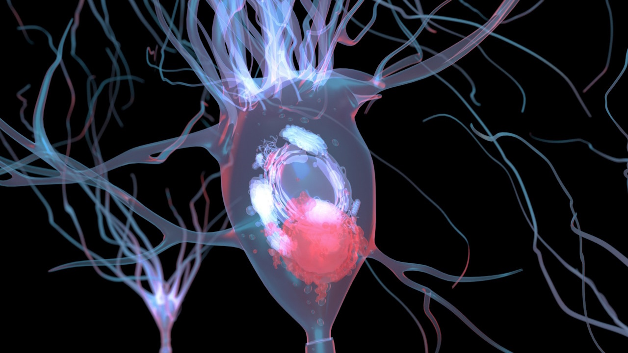 Ілюстрація нейрона з тільцями Леві всередині (білі).&amp;nbsp;Getty