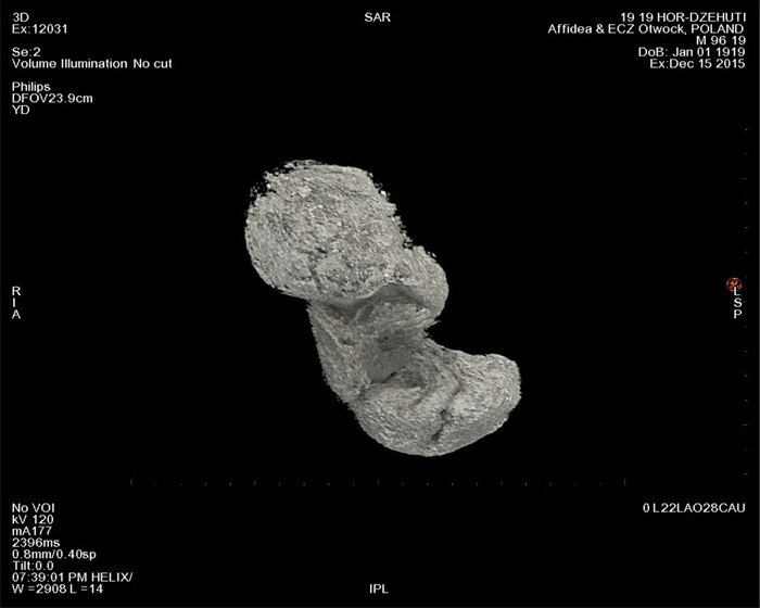 Об'ємна візуалізація плода за даними КТ / Warsaw Mummy Project