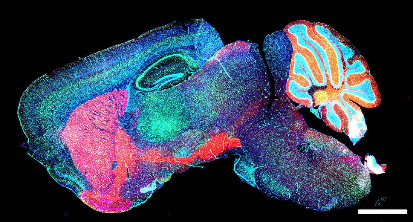 ГАМК-нейрони мишачого мозку. Yayun Wan