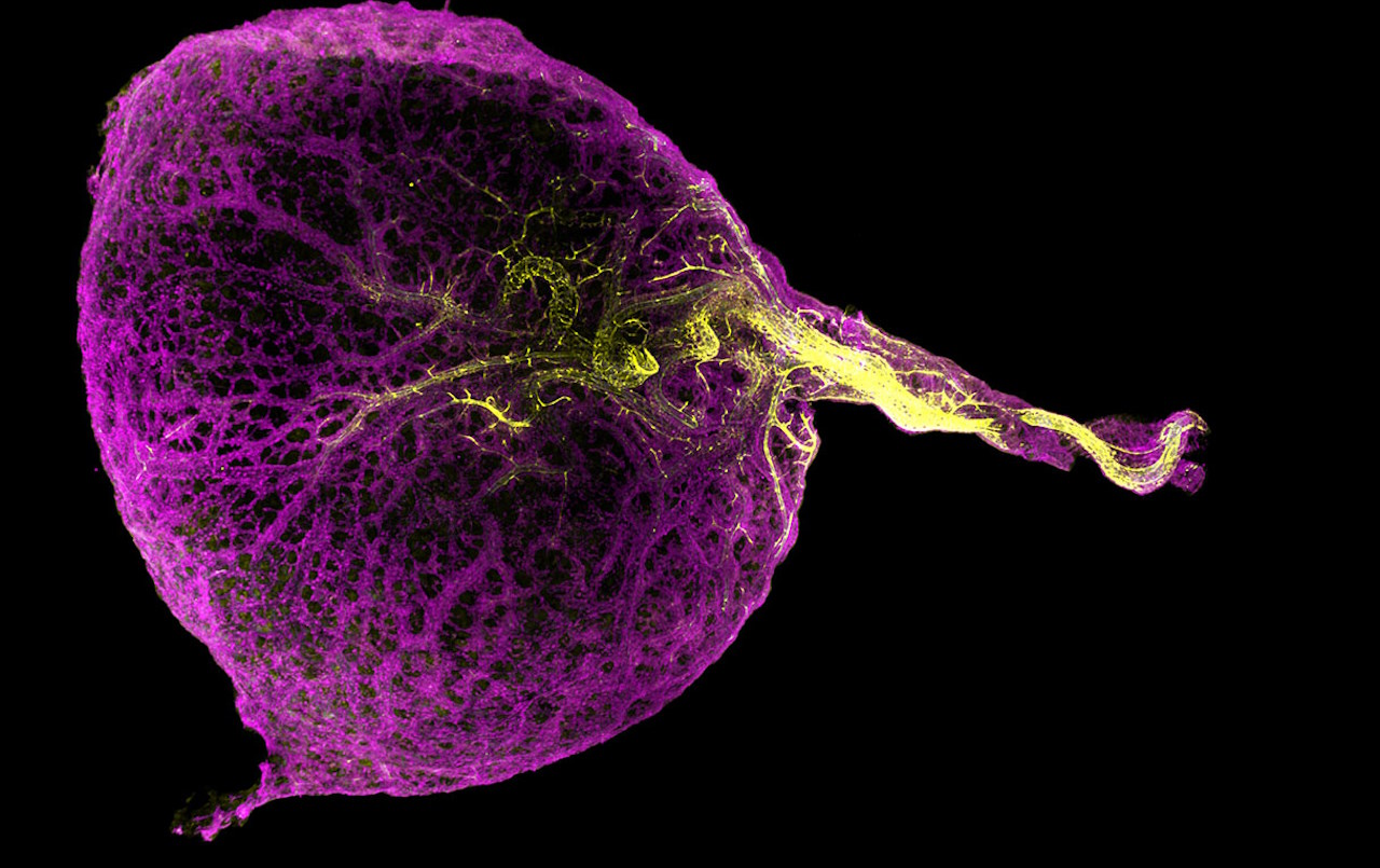 Жовтковий мішок 7-тижневого людського ембріона.&amp;nbsp;Megumi Innoe and Yorick Gitton
