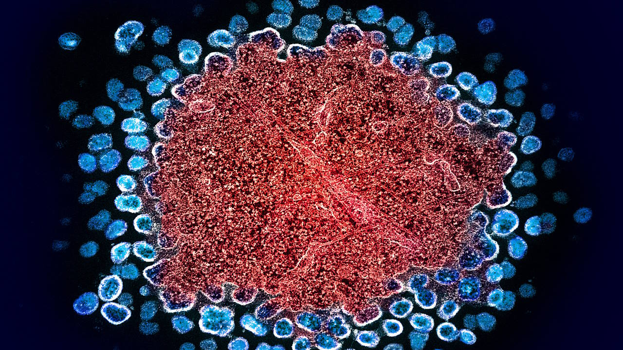 Інфікована Т-клітина (червона) вивільняє частинки ВІЛ (сині).&amp;nbsp;NIAID
