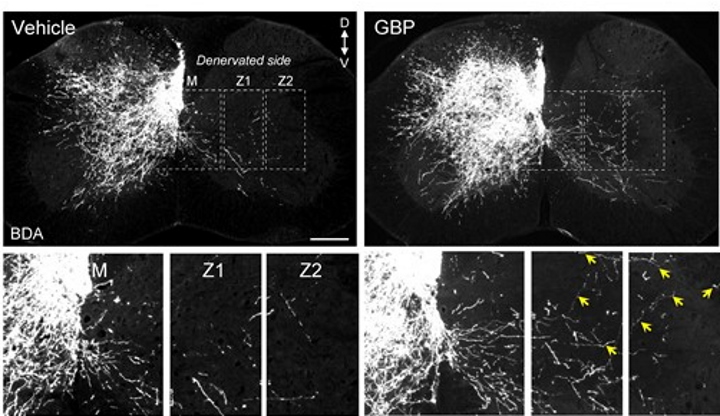 Відновлення кортикоспинального шляху мишей після інсульту. Зліва - контрольні, справа - ліковані габапентином.&amp;nbsp;Andrea Tedeschi et al. /&amp;nbsp;Brain, 2022
