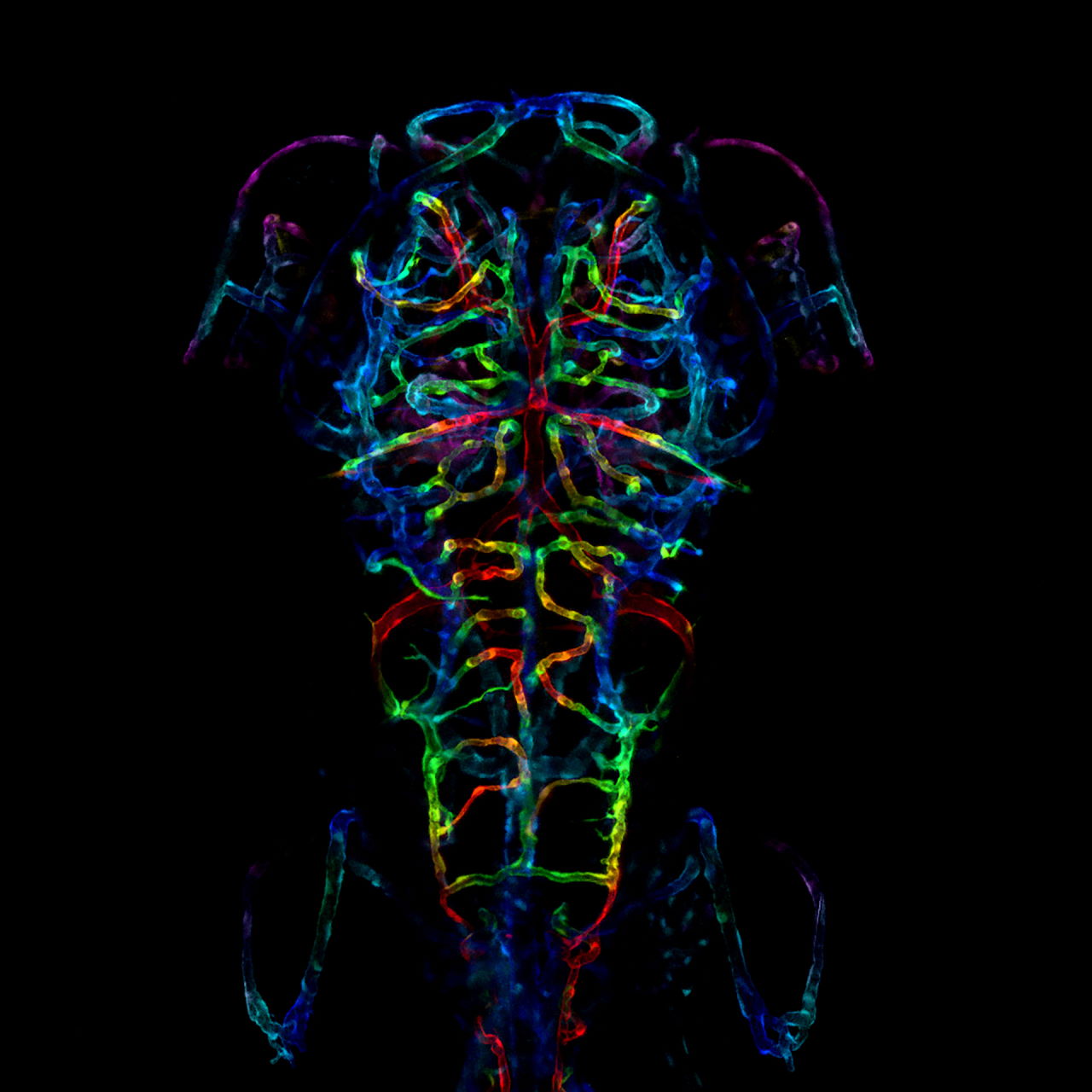 Нервова система ембріона рибки даніо-реріо на шостий день після зачаття. LayraCintron-Rivera