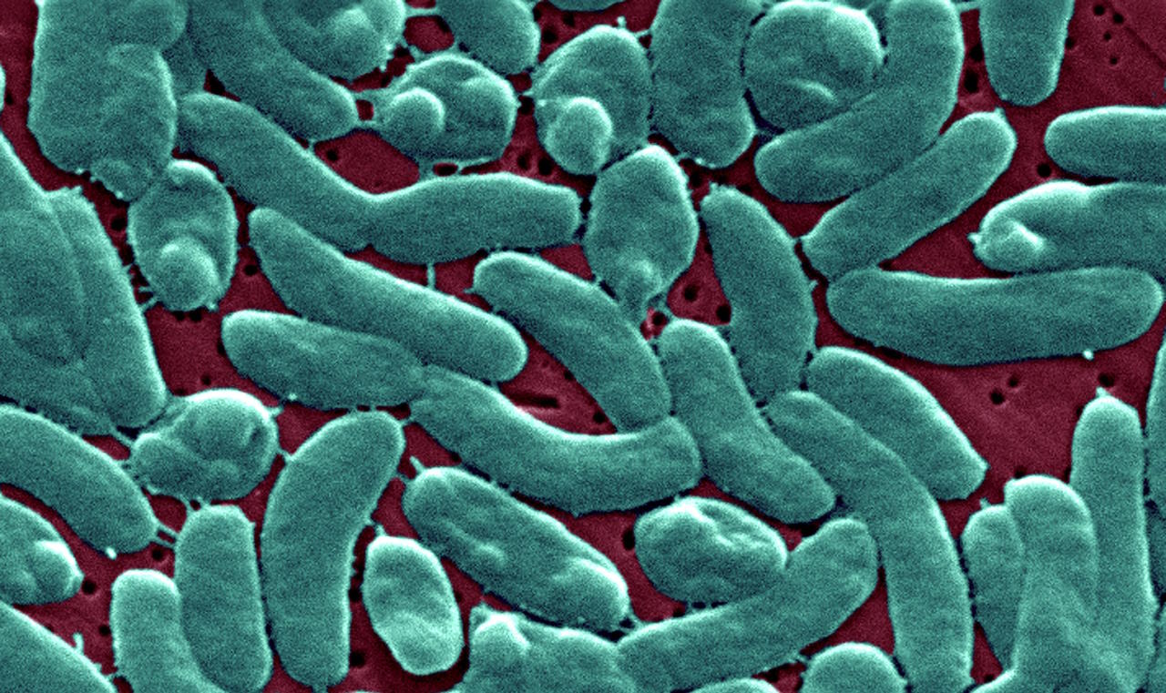 Vibrio vulnificus.&amp;nbsp;CDC / James Gathany /&amp;nbsp;Wikimedia Commons