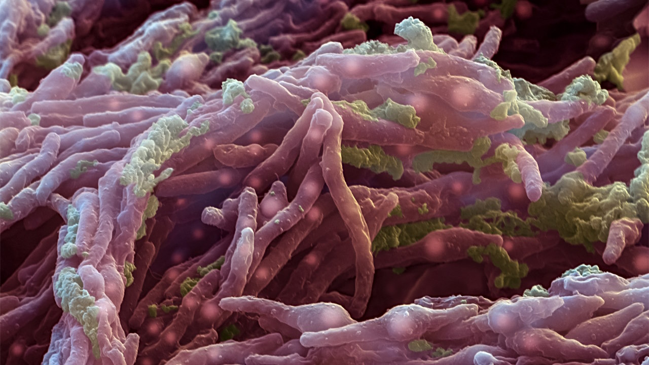 Мікобактерії туберкульозу.&amp;nbsp;EYE OF SCIENCE / SCIENCE SOURCE