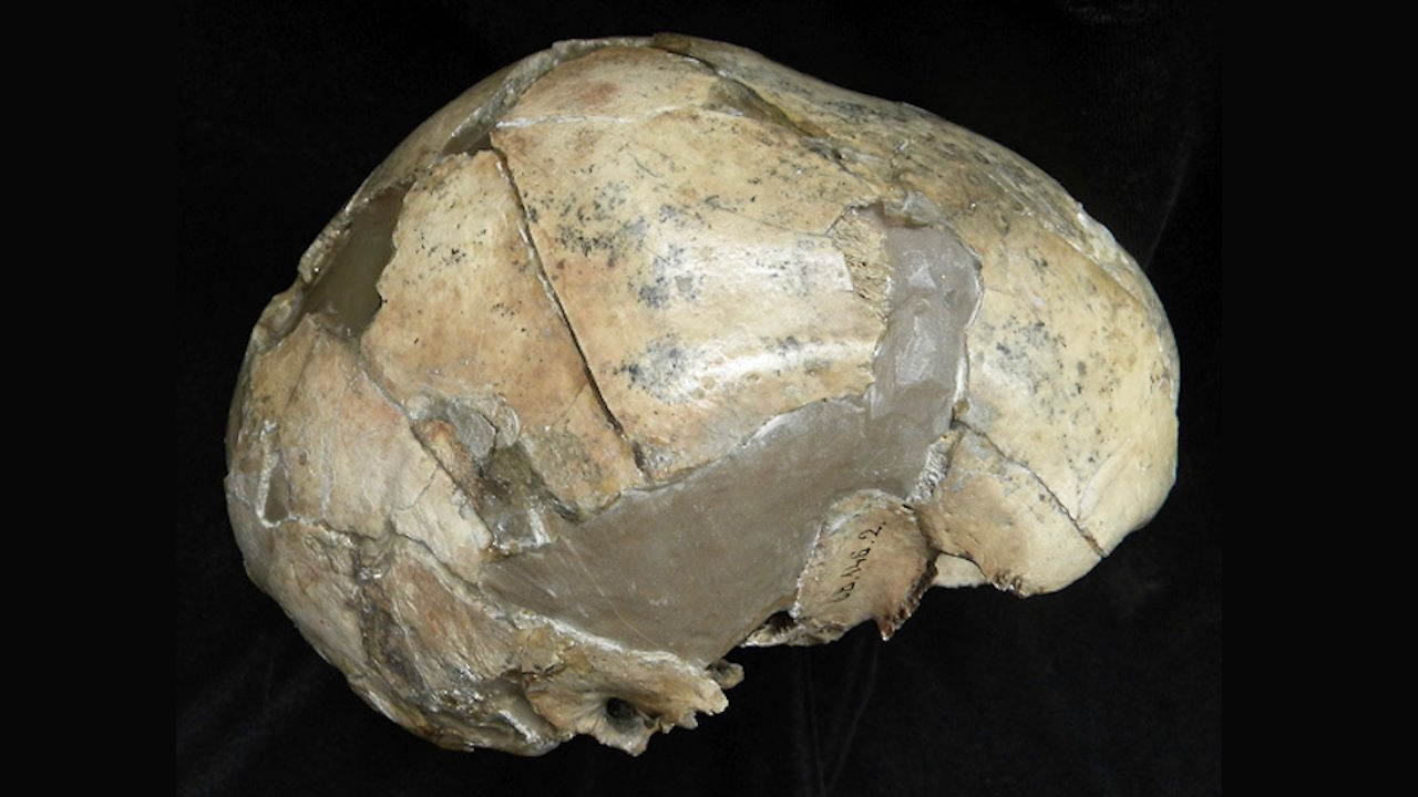 Зібрані фрагменти черепа неандертальської дитини.&amp;nbsp;György Pálfi et al. /&amp;nbsp;Tuberculosis, 2023