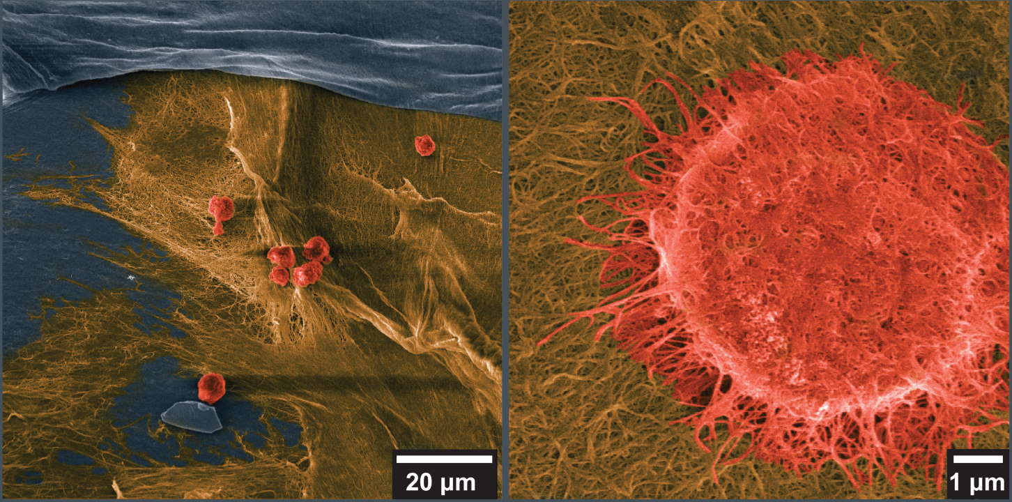 Мікрофотографії клітин (червоні) хрящової тканини на комбінованій гідрогелевій матриці (жовта).&amp;nbsp;Cameron Darkes-Burkey et al. /&amp;nbsp;Proceedings of the National Academy of Sciences, 2022