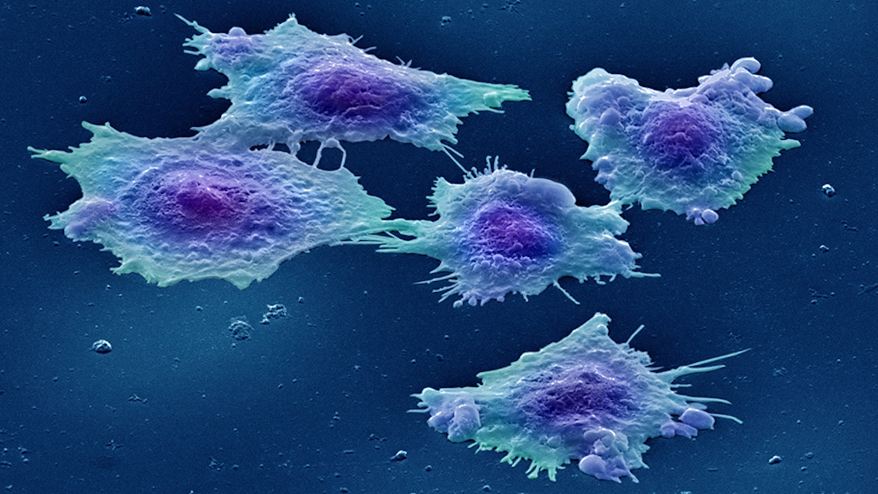 Клітини раку товстої кишки.&amp;nbsp;Genetic Engineering &amp;amp; Biotechnology News