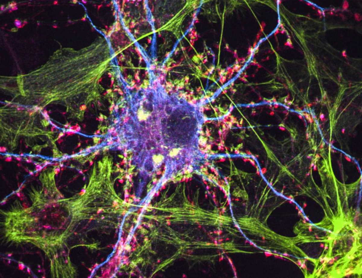 Нервові клітини. Lindsay Cameron / UC Davis
