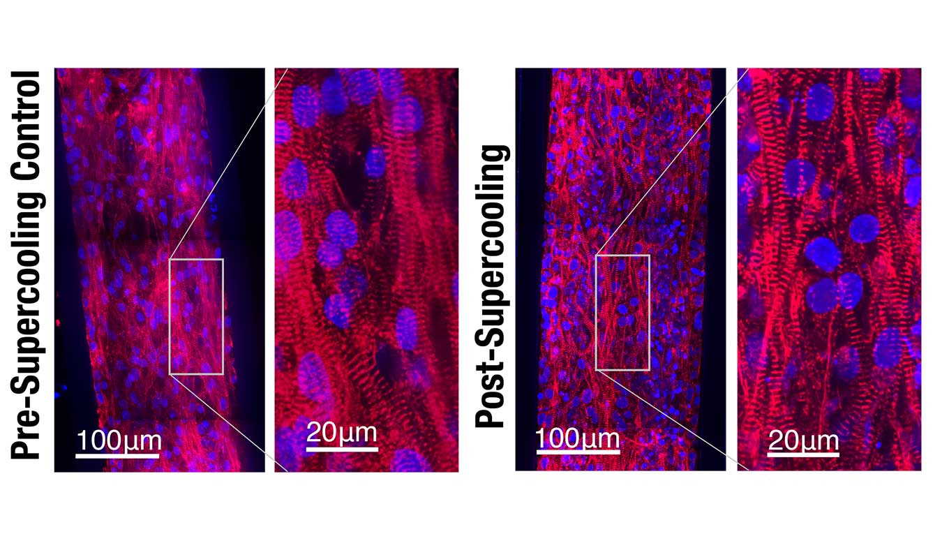 Отримані за допомогою конфокального мікроскопа зображення серцевих саркомерів до (зліва) та після (справа) охолодження. Matt Powell-Palm / UC Berkeley