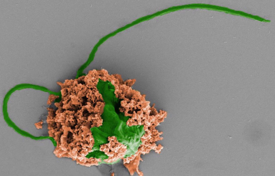Мікророботи з водоростей допомогли врятувати мишей від пневмонії