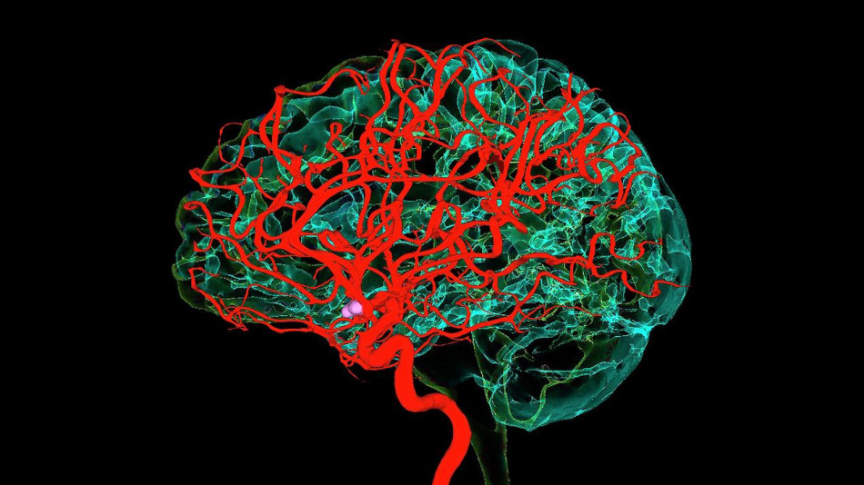 Зміни у дев'яти ділянках мозку пов'язали з гіпертензією і деменцією