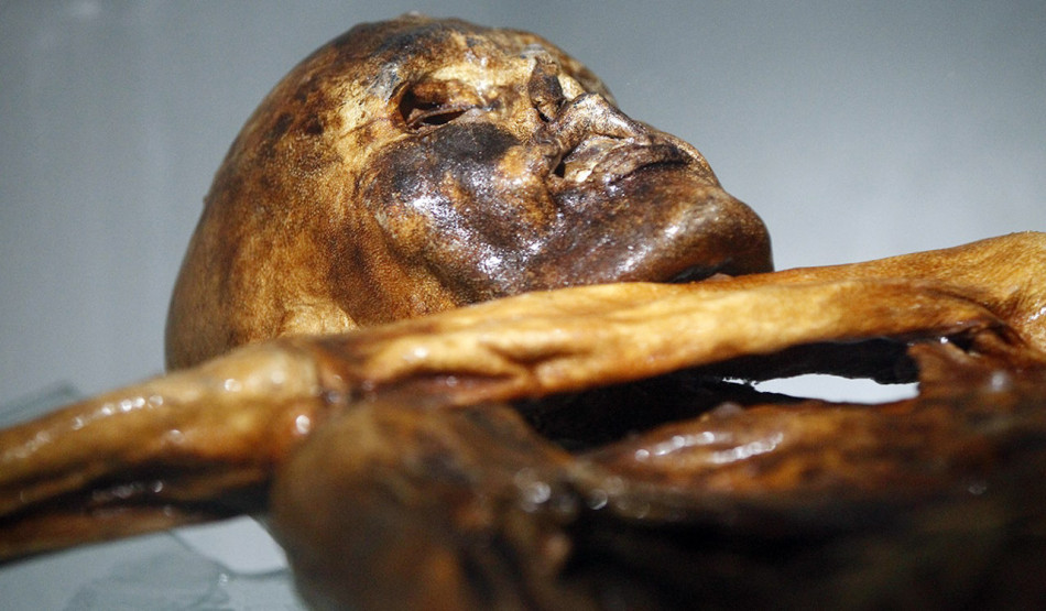 Муміфікований 5 000 років тому Етці виявився темношкірим лисіючим чоловіком