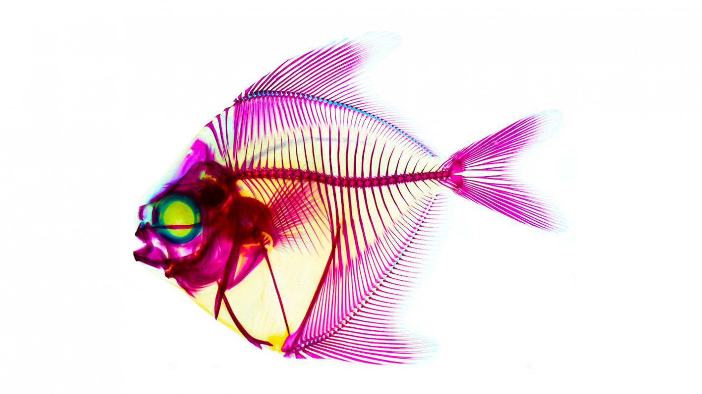 Життя розміром із зернинку. Оголошено переможців Nikon Small World Photomicrography Competition 2025