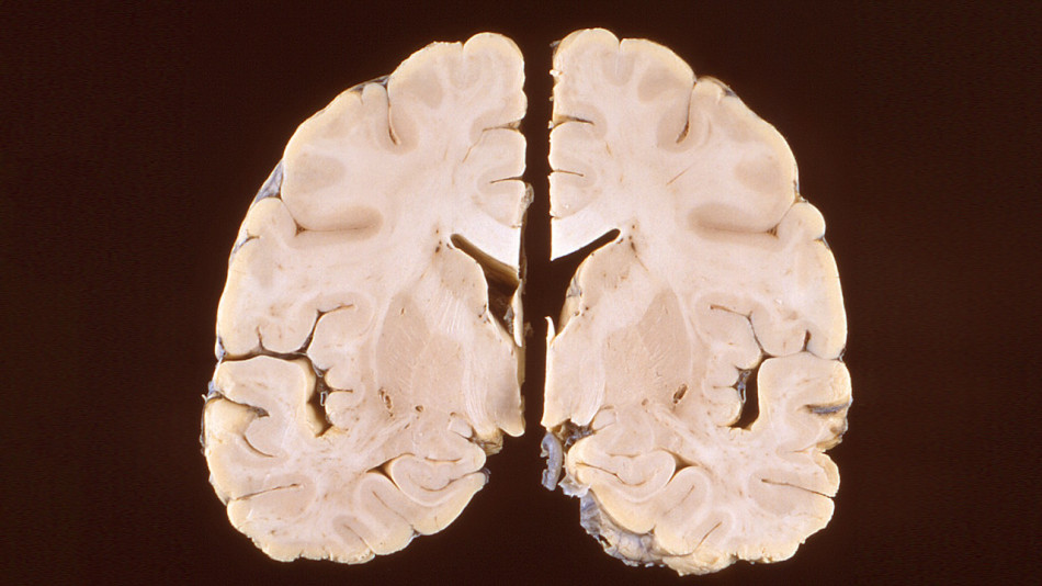 Теплокровність і здатність народжувати великих нащадків збільшила мозок тварин