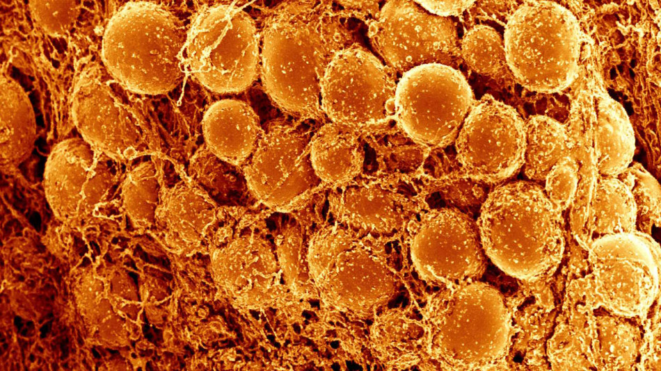 Жирові клітини допомогли відновити хребет у пацюків з остеопорозом