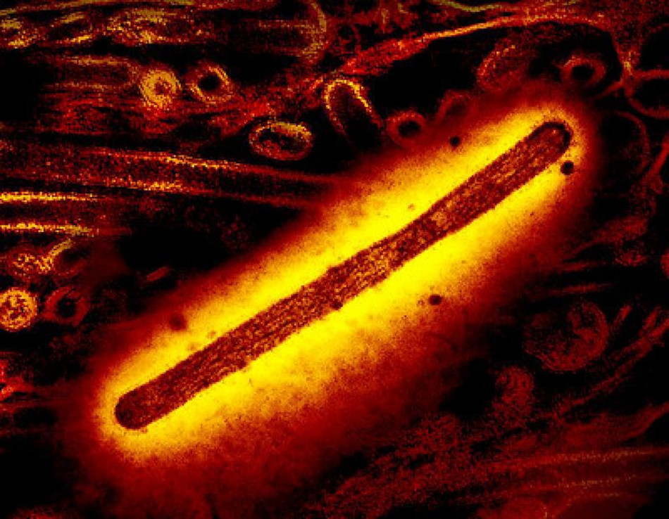 У США людина померла від пташиного грипу H5N5. Це перший випадок зараження у світі