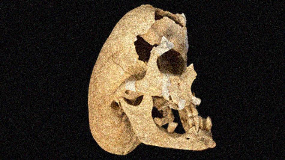 Рідкісна деформація черепа не завадила середньовічному іспанцю стати лицарем і загинути в бою