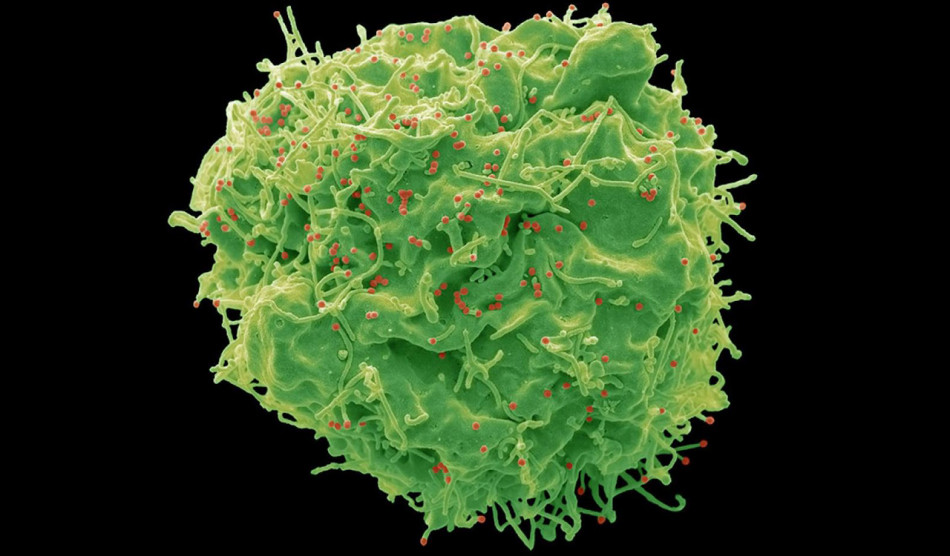 В Африці почали профілактику ВІЛ за допомогою препарату з 99-відсотковою ефективністю