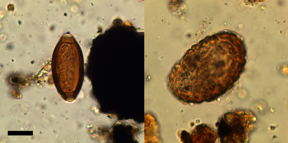 Римські солдати на півночі Британії постраждали від діареї та паразитів