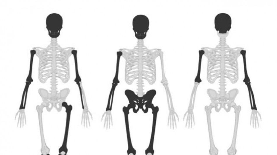 Кістки з американського колодязя виявилися рештками 36 темношкірих рабів. Їх туди скинули студенти-медики у XIX столітті