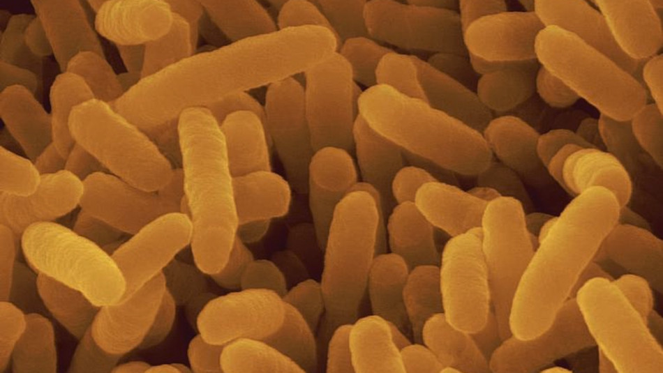 Біологи навчили бактерії світитися у кишківнику тварин. Вони допоможуть виявляти хвороби