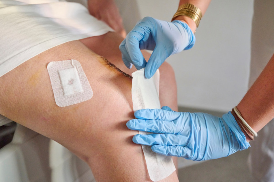 Гідрогель з киснем допоможе лікувати хронічні рани в людей із діабетом