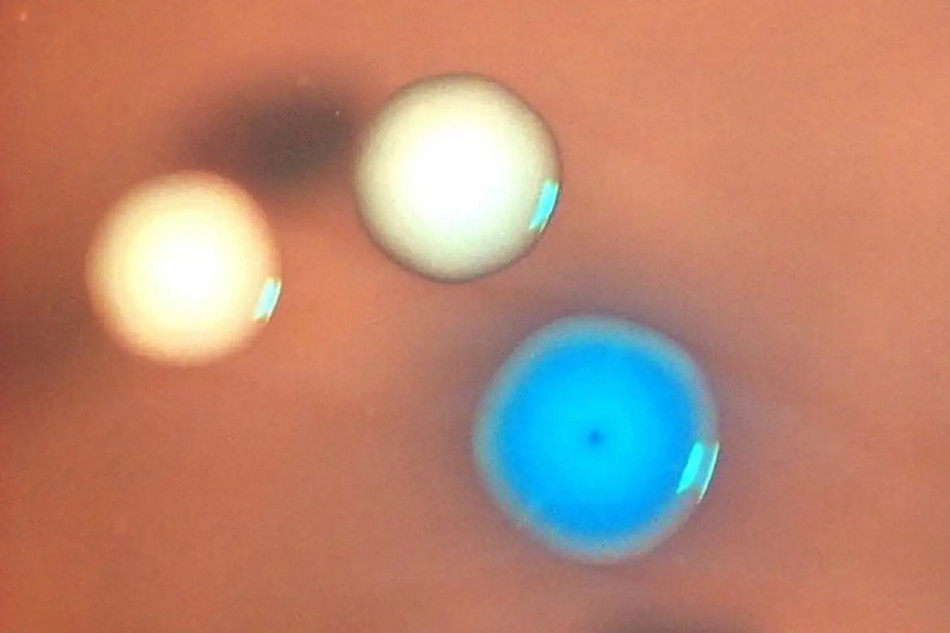 Біологи вбили геном бактерії та підселили їй синтетичну ДНК іншого виду. Клітина ожила