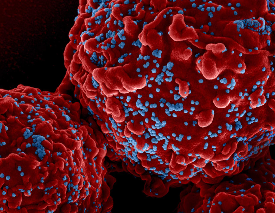 Пересадка стовбурових клітин від брата вилікувала норвежця й від раку крові, і від ВІЛ