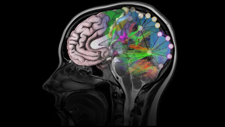 Препарати на основі антитіл при хворобі Альцгеймера назвали не ефективнішими за плацебо