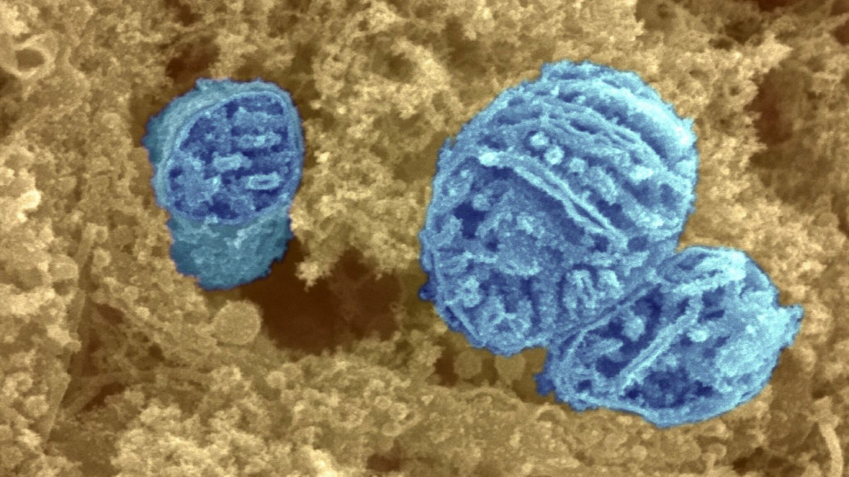 «Осліплі» клітини сітківки мишей знову відреагували на світло після пересадки мітохондрій