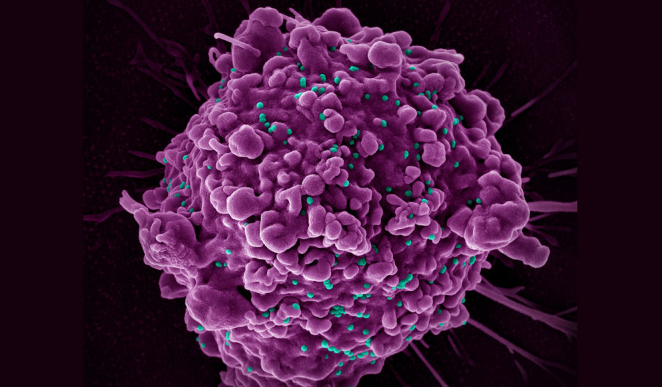 Антиретровірусна терапія загальмувала природний добір генів стійкості до ВІЛ. Але дозволила інфікованим людям жити довше