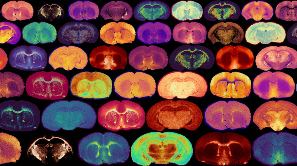 Цукор у мозку мишей пришвидшив поділ клітин-мішеней розсіяного склерозу